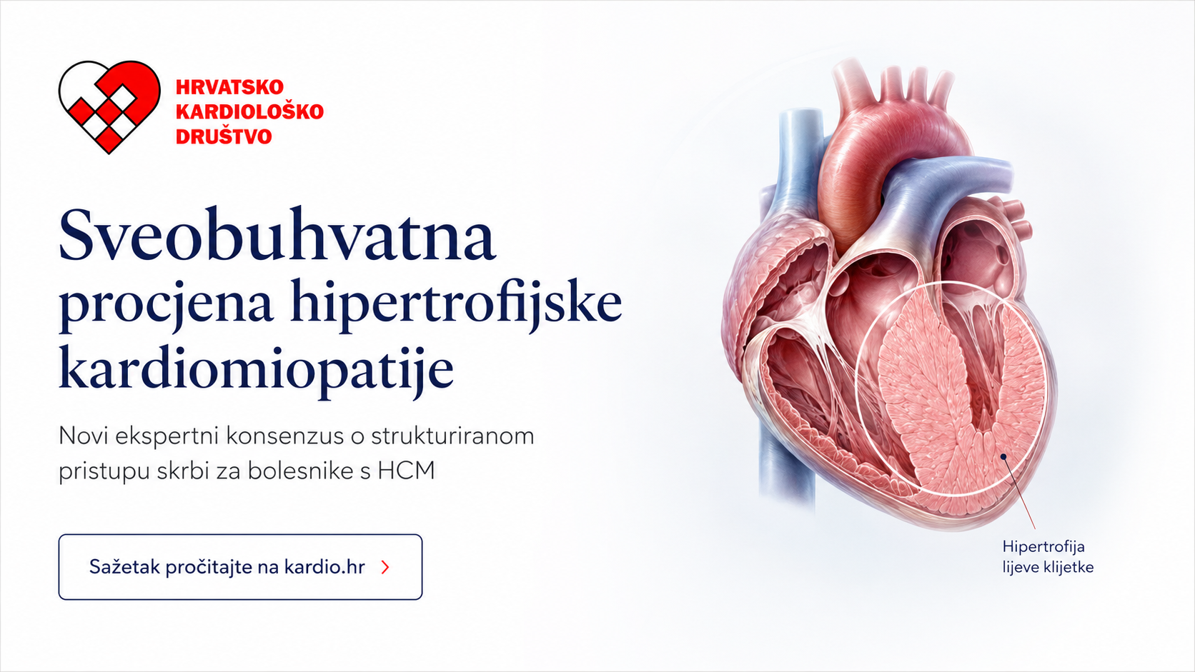 Sveobuhvatna procjena hipertrofijske kardiomiopatije
